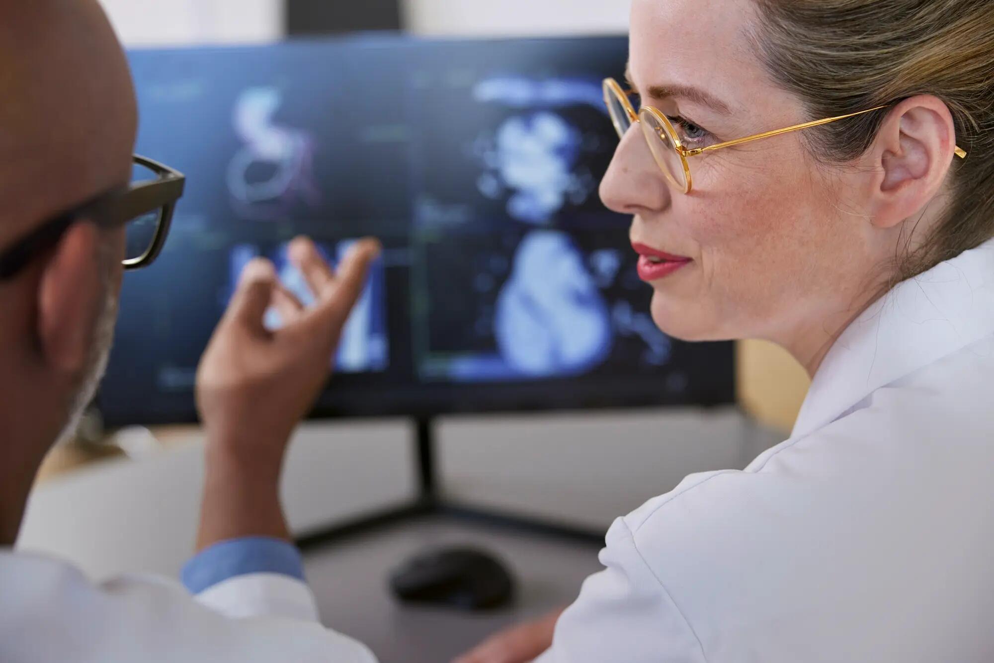 Radiology team discussing findings on a scan.