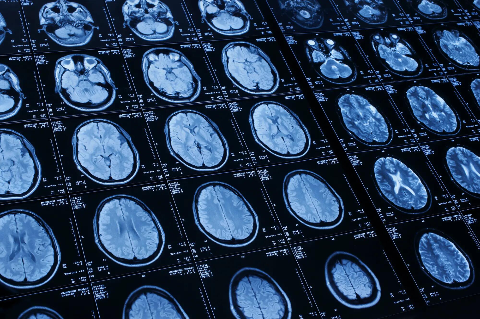 Scan of a human brain.jpg